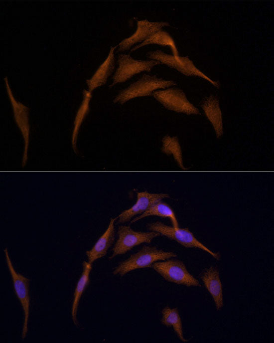 AMPKα2 Rabbit pAb