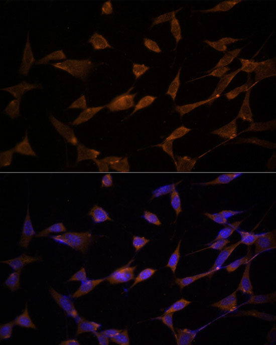 AMPKα2 Rabbit pAb