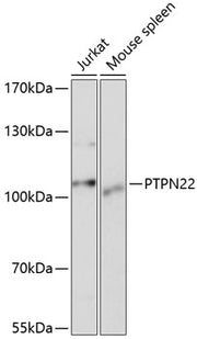 PTPN22 Rabbit pAb