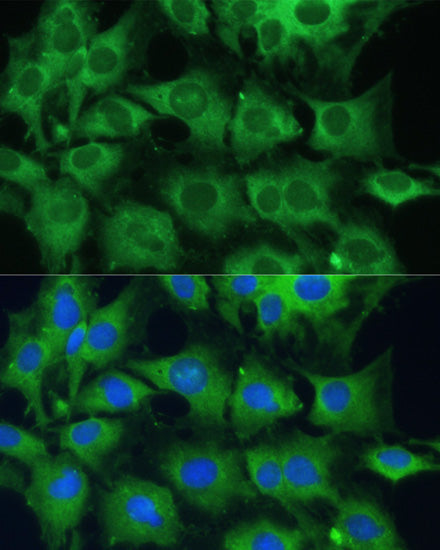 PTPN22 Rabbit pAb