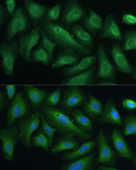 PTPN22 Rabbit pAb