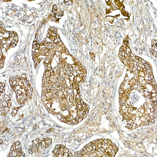 Mesothelin Rabbit pAb