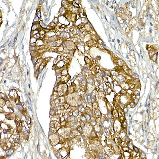 Mesothelin Rabbit pAb