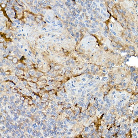 Mesothelin Rabbit pAb