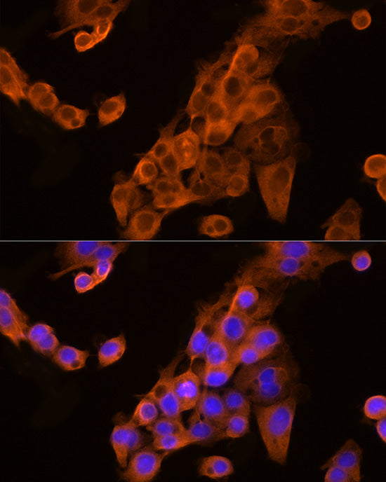Apolipoprotein C3 Rabbit pAb