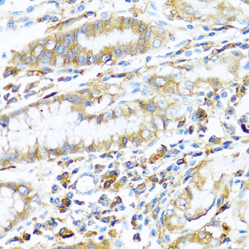 HLA-DPB1 Rabbit pAb