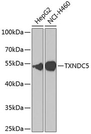 TXNDC5 Rabbit pAb