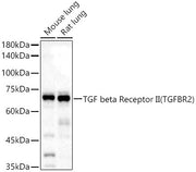TGF beta Receptor II Rabbit pAb