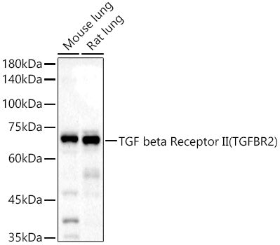 TGF beta Receptor II Rabbit pAb