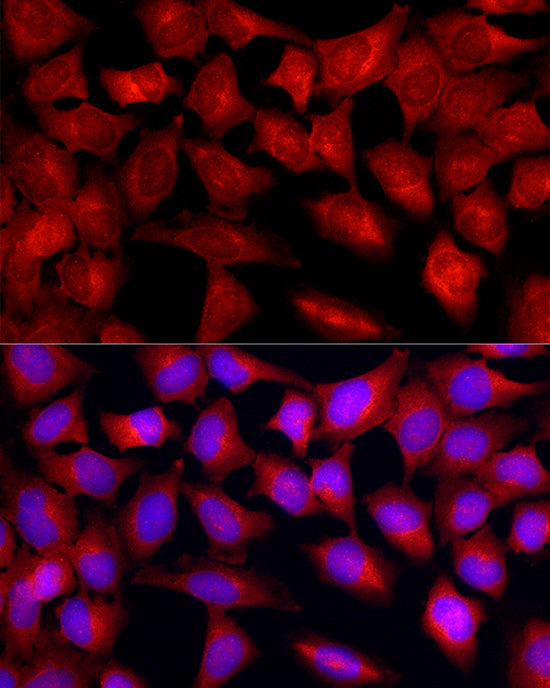 TGF beta Receptor II Rabbit pAb