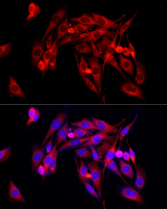 TGF beta Receptor II Rabbit pAb