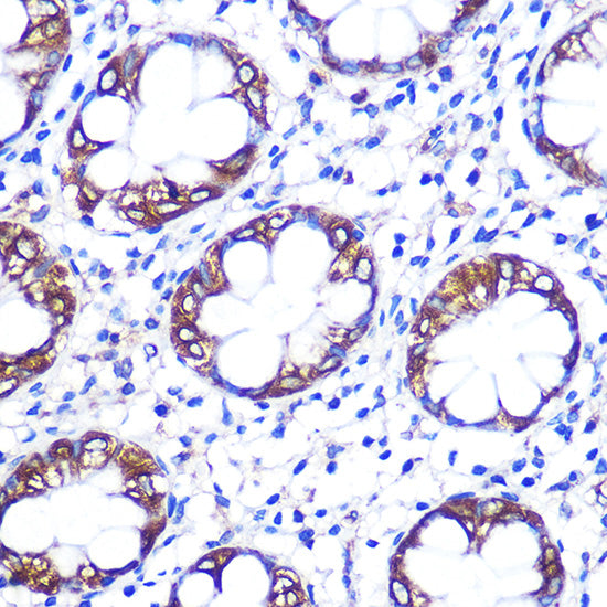 Serotonin transporter Rabbit pAb