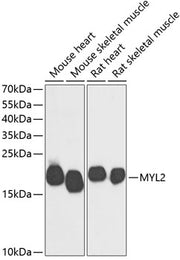 MYL2 Rabbit pAb