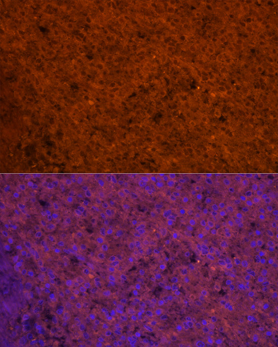 CCL5/RANTES Rabbit pAb