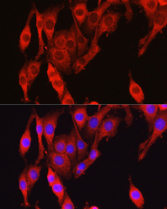 Vinculin Rabbit pAb