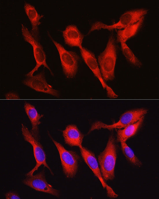 Vinculin Rabbit pAb