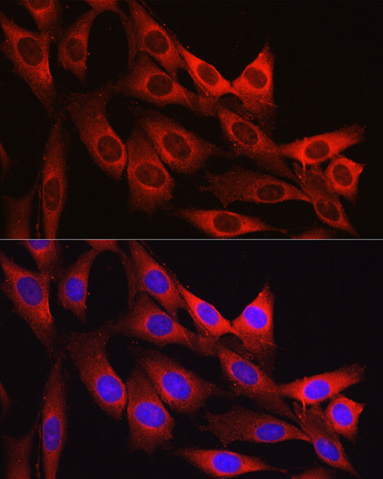 Vinculin Rabbit pAb