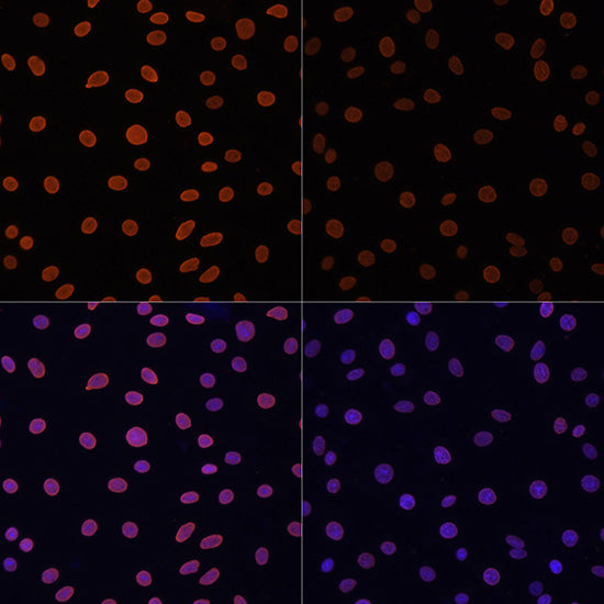 Acetyl-Histone H4-K12 Rabbit pAb