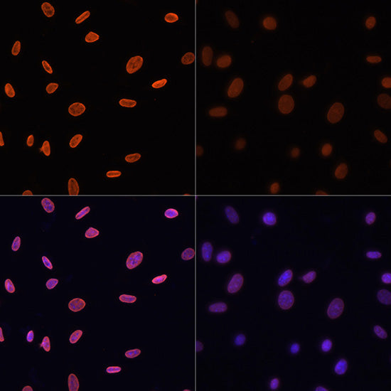 Acetyl-Histone H4-K12 Rabbit pAb