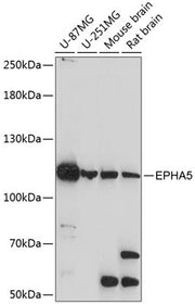 EPHA5 Rabbit pAb