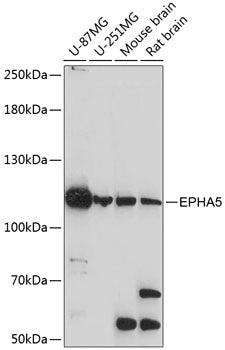 EPHA5 Rabbit pAb