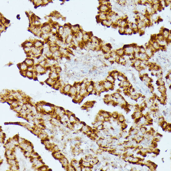HMGCS2 Rabbit pAb