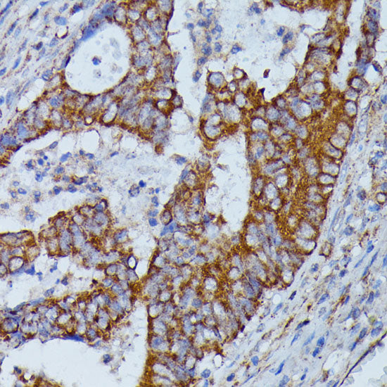 HMGCS2 Rabbit pAb