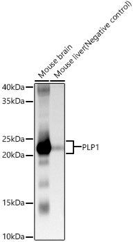 PLP1 Rabbit pAb