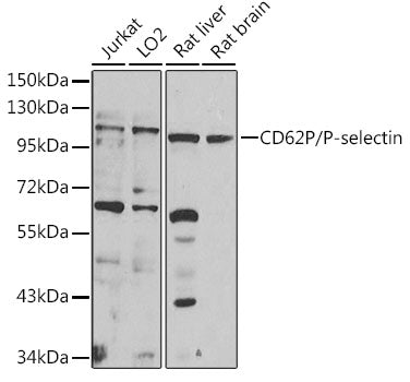 CD62P/P-selectin Rabbit pAb