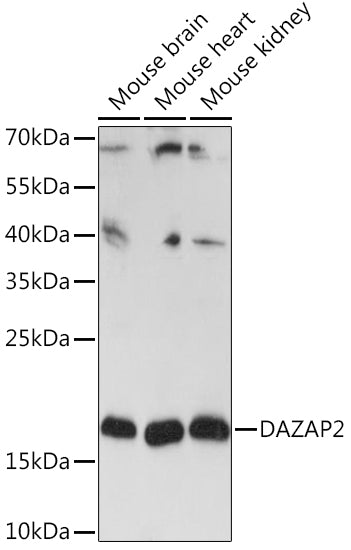 DAZAP2 Rabbit pAb