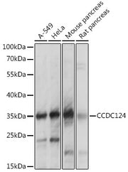 CCDC124 Rabbit pAb