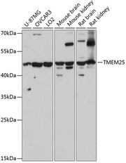 TMEM25 Rabbit pAb