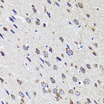 CCDC124 Rabbit pAb