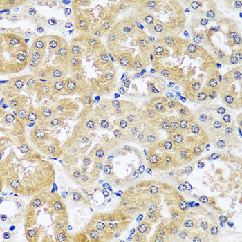 CCDC124 Rabbit pAb