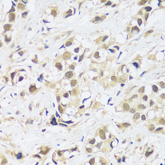 ASCL4 Rabbit pAb