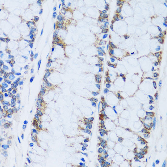 CA13 Rabbit pAb