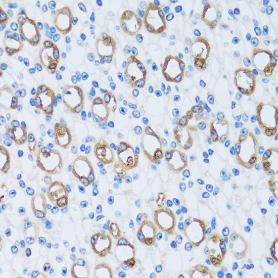 CA13 Rabbit pAb
