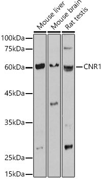 CNR1 Rabbit pAb