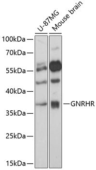 GNRHR Rabbit pAb