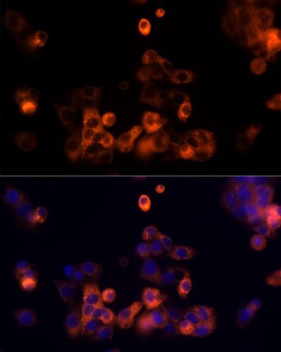 Transferrin Rabbit pAb