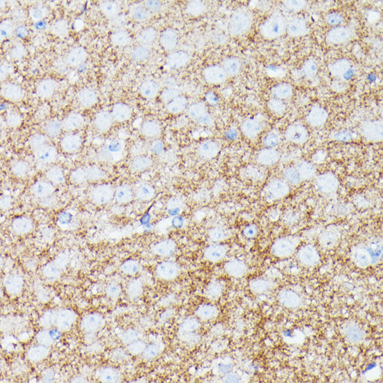 gamma-Synuclein Rabbit pAb