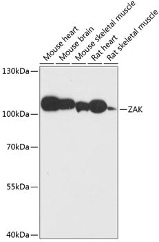 ZAK Rabbit pAb