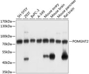 POMGNT2 Rabbit pAb
