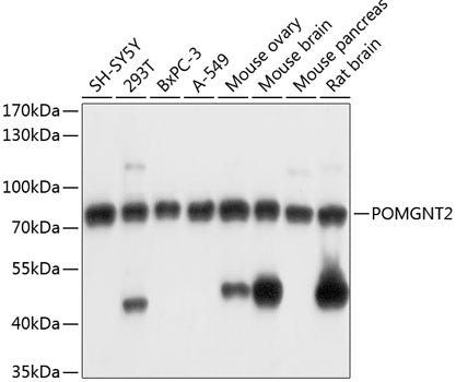 POMGNT2 Rabbit pAb