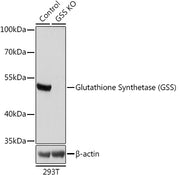 [KO Validated] Glutathione Synthetase (GSS) Rabbit pAb
