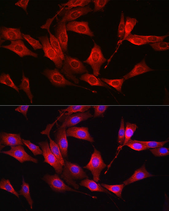 [KO Validated] Glutathione Synthetase (GSS) Rabbit pAb