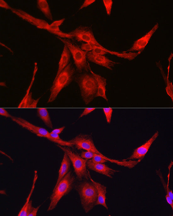 [KO Validated] Glutathione Synthetase (GSS) Rabbit pAb