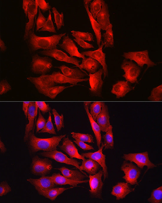 [KO Validated] Glutathione Synthetase (GSS) Rabbit pAb