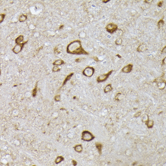 [KO Validated] PHD2/EGLN1 Rabbit pAb