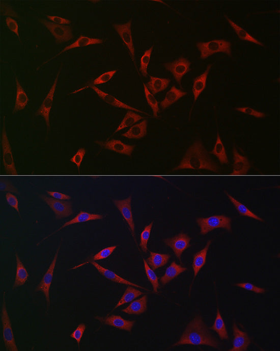[KO Validated] PHD2/EGLN1 Rabbit pAb